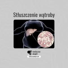 Stłuszczenie wątroby: powiększona wątroba z widocznym nagromadzeniem lipidów w komórkach.