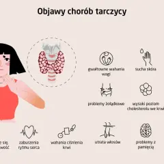 Ilustracja przedstawia objawy chorób tarczycy, takie jak wahania wagi, sucha skóra, problemy z sercem i pamięcią. Warto skonsultować się z lekarzem od tarczycy.