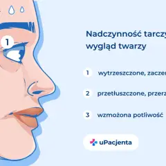 Chora tarczyca objawy: wytrzeszczone oczy, przetłuszczone włosy i wzmożona potliwość. Ilustracja twarzy z zaznaczonymi symptomami.