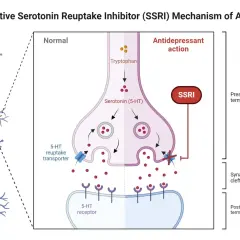 Schemat działania SSRI. Po lewej neuron, po prawej synapsa. SSRI blokuje transporter serotoniny, zwiększając jej dostępność w szczelinie synaptycznej.