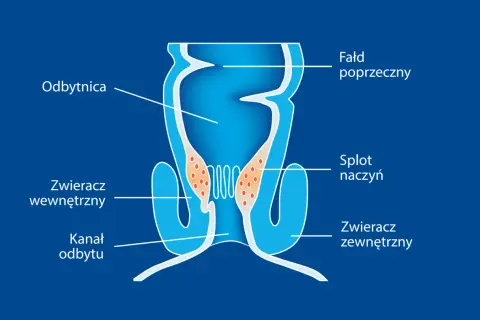 Schemat przedstawia budowę odbytnicy, kanału odbytu, zwieraczy i splotu naczyniowego. Ilustracja może pomóc zrozumieć mechanizm wypadania odbytu.