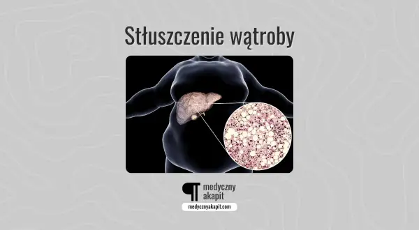 Stłuszczenie wątroby: powiększona wątroba z widocznym nagromadzeniem lipidów w komórkach.