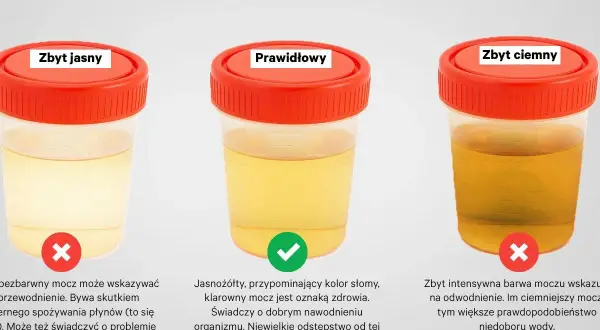 Trzy pojemniki z próbkami moczu o różnym zabarwieniu: zbyt jasnym, prawidłowym i zbyt ciemnym.