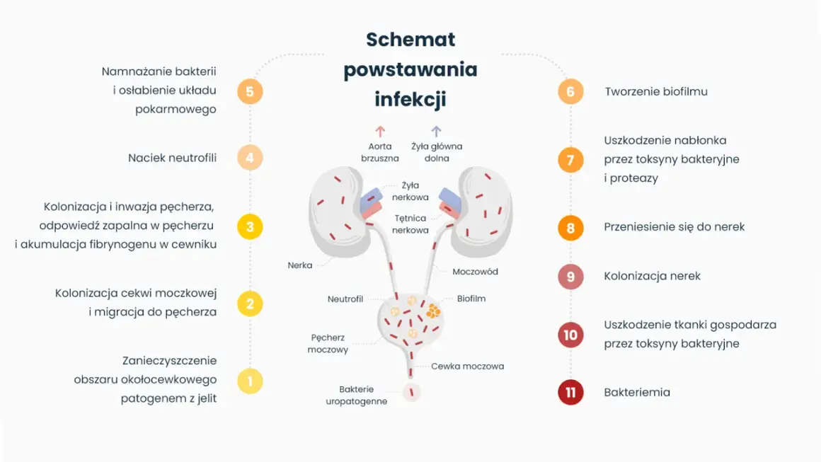 Schemat powstawania infekcji, od namnażania bakterii, przez zapalenie pęcherza, po uszkodzenie nerek i bakteriemię.