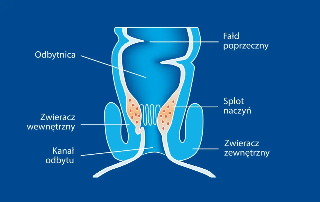 Schemat odbytu z zaznaczonym splotem naczyń, który może być przyczyną krwawienia z odbytu.