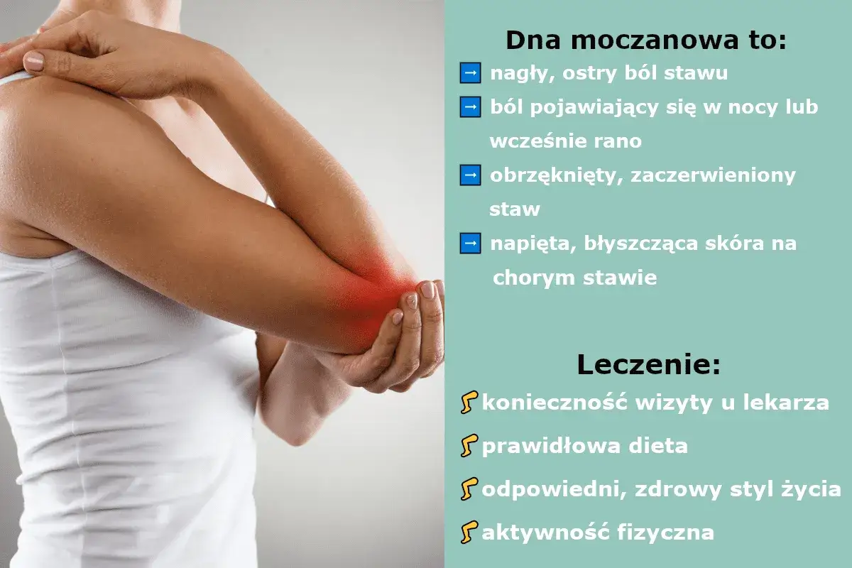 Dna moczanowa objawy skórne: zaczerwieniony, obrzęknięty staw łokciowy, ból. Leczenie: wizyta u lekarza, dieta, zdrowy styl życia.