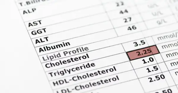 Wynik badania lipidogramu: trójglicerydy 1.5 mmol/l, co mieści się w normie. Widoczne też inne parametry jak cholesterol.