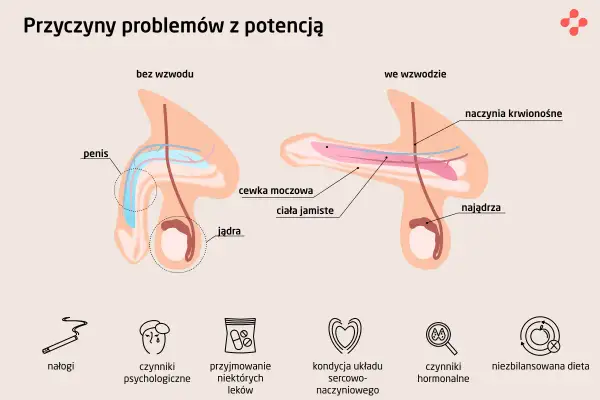Ilustracja pokazuje budowę penisa bez i we wzwodzie, wyjaśniając przyczyny impotencji. Wymieniono nałogi, czynniki psychologiczne i inne.