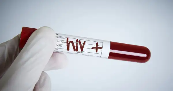 Rękawiczka medyczna trzyma probówkę z krwią oznaczoną "hiv +". Wynik testu na aids jest pozytywny.
