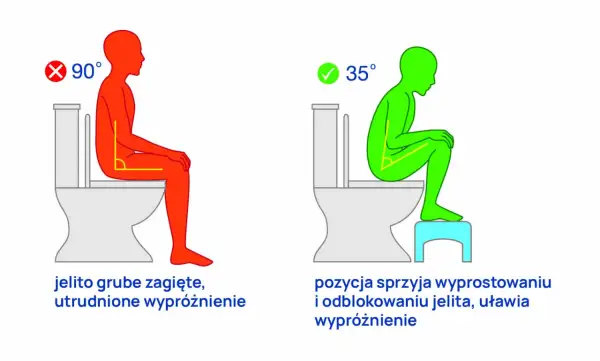 Zła pozycja na toalecie (90°) powoduje obstrukcję jelit. Dobra pozycja (35°) ułatwia wypróżnienie.