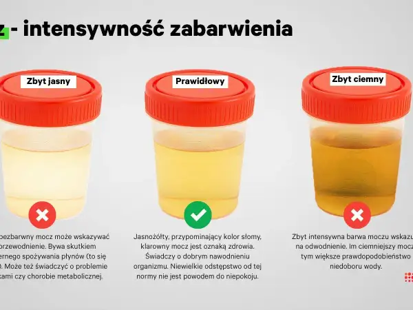 Trzy pojemniki z próbkami moczu o różnym zabarwieniu: zbyt jasnym, prawidłowym i zbyt ciemnym.