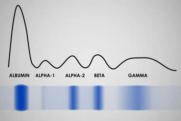 Wykres proteinogramu z frakcjami: albuminy, alfa-1, alfa-2, beta i gamma. Widoczne pasma elektroforetyczne.